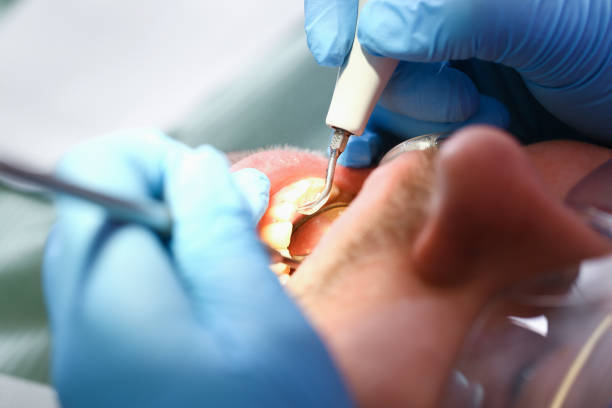 Best Dentist for Tooth Abscess  in Countryside, VA